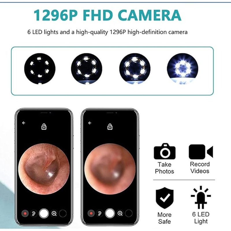 Ralyuni NE3 Pro Wireless Ear Cleaner | 1296P HD Endoscope with LED Light & App